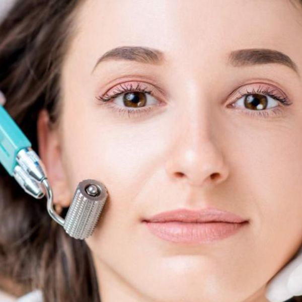 Microneedling / Nutrición Celular